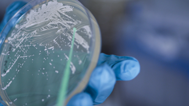 Kädessä olevasta petrimaljasta tutkitaan mikrobeja.